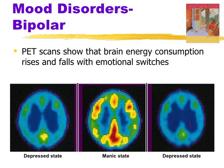 Позитронно-эмиссионная томограмма показывает, что потребление мозгом энергии растёт и падает при эмоциональных изменениях